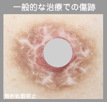 他院治療例
